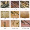 دستگاه اسکالپ مو و سر 5 کاره برند لیز