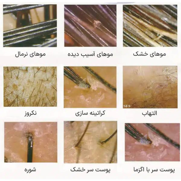 دستگاه اسکالپ مو و سر 5 کاره برند لیز